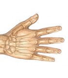 Artrosis y Artritis